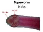 Tapeworm_scolex